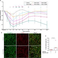 Martes, 3 de mayo de 2011. Frontiers Endothelial Barrier Integrity Is Disrupted In Vitro By Heme And By Serum From Sickle Cell Disease Patients Immunology