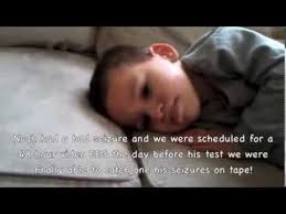 Your child may be confused and sleepy. Partial Focal Seizure Child Toddler Life As A Twin Mom Youtube