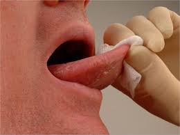 Hpv Related Mouth And Throat Cancers Rising By 2 5 Each Year Dentistry Today