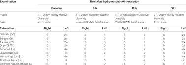 Image result for Motor Exam
