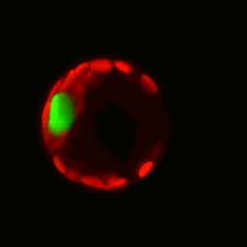 What does a plant cell nucleus look like. New Look Inside Cell Nucleus Could Improve Cancer Diagnostics