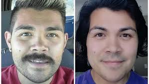 Fundraiser by Jackie Olson : Jackie's FFS & Recovery Fund