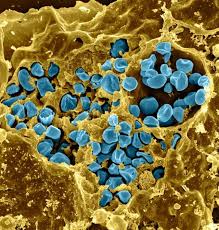 Image result for Intracellular Bacteria
