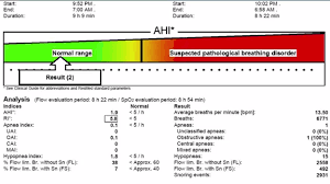 We did not find results for: How Does A Home Sleep Study Work Apnea Today