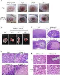 A Observation On Necrosis In Tumor After Treatment Of Kml001 In Ct26 Download Scientific Diagram