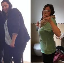 Falten müssen kein schicksal sein, denen man wehrlos ausgeliefert ist. Vorher Nachher Torsten Prix Der Abnehmexperte