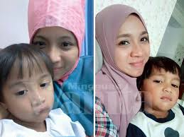 Masalah ini dapat berupa luka ringan, memar di kulit kepala, bengkak, perdarahan, patah tulang tengkorak, atau gegar otak. Kalau Jatuh Terduduk Cepat Ke Hospital Jangan Mak Mak Cuba Tanggung Sakit Dan Rasa Diri Tu Kuat Mingguan Wanita