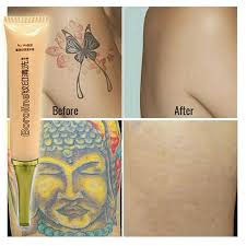 Tattoos can also hurt more permanent makeup is a type of permanent tattoo that people use around the eyes, lips, or eyebrows to look like makeup. Hot Permanent Tattoo Removal Cream No Need For Pain Removal Maximum Strength Tus Ebay