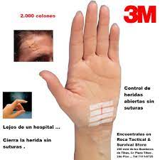 La Casa Del Montanista Outdoor Store Suturas Adhesivas Steri Strips Para Cerrar Heridas Abiertas Especialmente Disenado Encuentralas En Roca Tactical Tel 7111 6725 Con Eduardo Herida Abierta Hospital