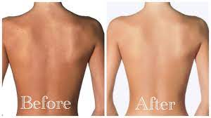 We recommend you use a cleanser to wash your body as it will take off the strong smell of yogurt. How To Brighten Your Body In 10 Days Remove Uneven Skintone Youtube