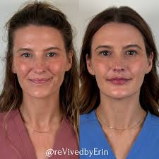 rēVive Medical Aesthetics