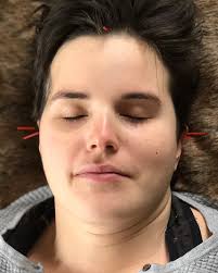 Dr Caroline Moody, DAOM, L.Ac.