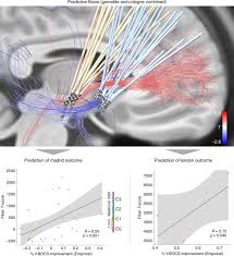 Target at an international scale, the target varies in size, but at the olympics, it is 122cm in diameter. A Unified Connectomic Target For Deep Brain Stimulation In Obsessive Compulsive Disorder Nature Communications