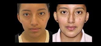 Dr. Giovani Ramírez Limón Cirujano maxilofacial, Puebla