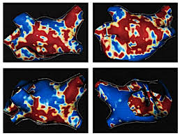 Los mejores juegos de ps2 para 2 personas / rankin. Diagnostics Free Full Text Left Atrial Structural Remodelling In Non Valvular Atrial Fibrillation What Have We Learnt From Cmr Html