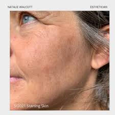 Natalie Walcott Esthetics (@nwalcottskin) • Instagram photos and videos