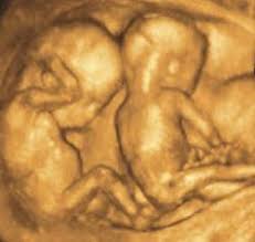 Bei der nächsten kontrolle wissen sie es dann eindeutig. Zwillinge In Der 16 Woche Ssw15 Babywelten Ch