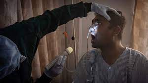 Entérate de quiénes están en riesgo de contagiarse con el «hongo negro» Hongo Negro 6 Preguntas Clave Sobre La Rara Infeccion Fungica Que Ataca A Pacientes De Covid 19 En India Bbc News Mundo