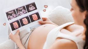 Berikut ini cara hitung usia kehamilan untuk mengetahui hari perkiraan lahir (hpl). Moms Ini Dia Ukuran Normal Hasil Usg Dan Tahapan Perkembangan Janin Orami