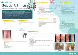 Image result for Septic Joint