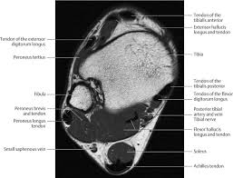 The origins of the lumbrical muscles are located at the distal end of the quadratus plantae muscle. Ankle And Foot Radiology Key