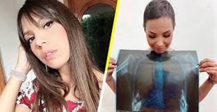 A darle Reyna': La historia de una chica que necesita ayuda para vencer al  cáncer por segunda vez