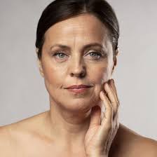 Flacidez y líneas de expresión