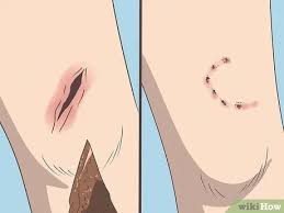 To help the injured skin heal, use petroleum jelly to keep the wound moist. How To Treat An Open Wound 15 Steps With Pictures Wikihow