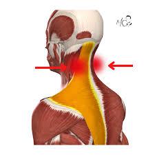 Dolore al collo lato destro o sinistro? La causa è il TRAPEZIO