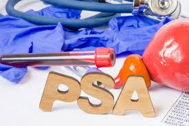 For reasons not yet determined, black people have a greater risk of prostate cancer than do people of other races. 5 Things To Know About Psa Numbers Vitus Prostate Center