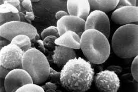 Sie sind vor allem für die blutgerinnung wichtig. Thrombozytenzahl Blutwerte Laborwerte Krank De