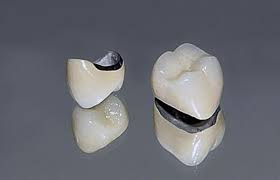 PFM Crown model preview