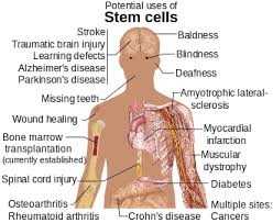 stem cell wikipedia