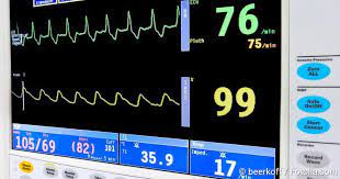 Wann es gefährlich wird und wie sie es sofort lindern. Herzrasen Tachykardie Ursachen Behandlung Selbsthilfe Netdoktor