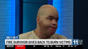 Colorado burn survivor starts organization after enduring car fire