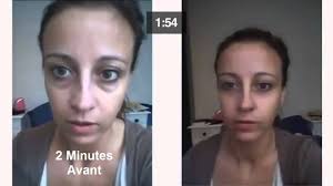 Des soins anticerne adaptés aux carnations foncées. Solution Pour Poches Et Cernes Sous Les Yeux Youtube