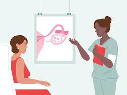 Image result for Anovulation