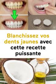 Pin On Astuces Naturelles