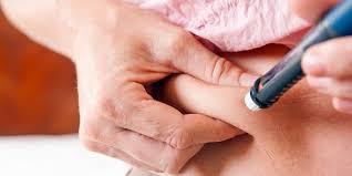 Type 2 diabetes is a chronic disease. Diabete Pas Si Facile De S Injecter L Insuline Correctement Femme Actuelle Le Mag