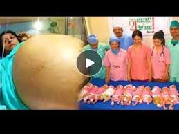 Teboho tsotetsi of tembisa township, ekurhuleni, said his wife, gosiame thamara sithole, 37, gave birth to decuplets at a pretoria hospital. Octomom Woman Who Gave Birth To 8 Babies From A Single Birth Nadya Denise Doud Suleman Gutierrez Youtube