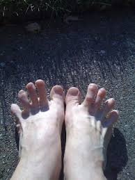 Behold The Class Bunion Exercises Bunion Exercises Foot Exercises Exercise