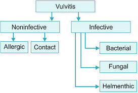 Image result for Vulvitis