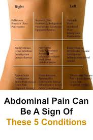 Know Your Stomach Pain Chart Www Bedowntowndaytona Com