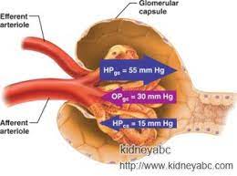 Pin Di Kidney Disease And Dialysis