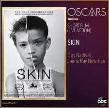 During their speech, free and roe thanked netflix, the academy, and joey bada$$, as well as highlighting ongoing issues of police brutality in the us. Skin Wins The Oscar For Best Live Action Short Social News Xyz