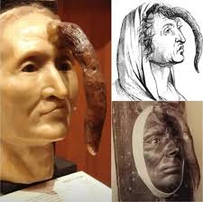 A bizarre 19th-century woman with a 9.8-inch male penis growing from her  forehead is now