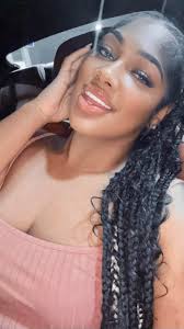 Anybody has an experience with Hollywood perfect smile?