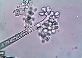 Image result for Botrytis cinerea
