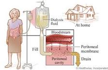 Image result