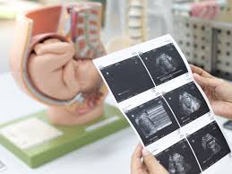 Misoprostol: o que é, para que serve e quais as contraindicações